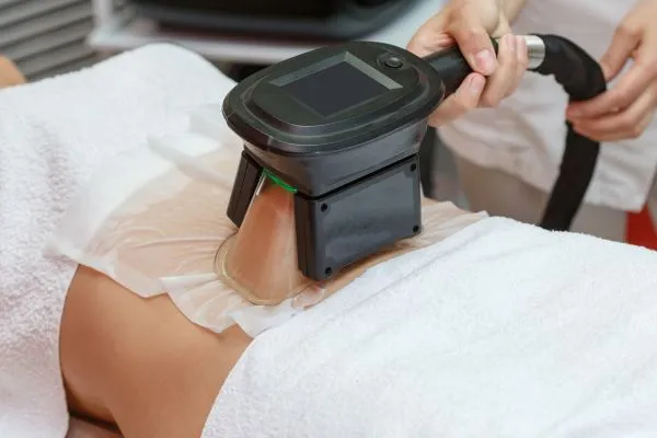 Image of person having fat freezing treatment to help weight gain Hampton
