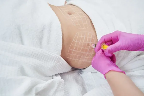 image of fat dissolving injections on love handles to help combat weight gain Hampton